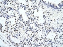 MED6 Rabbit anti-Human, Polyclonal, Novus Biologicals:Antibodies:Primary